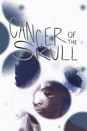 Cancer of the Skull